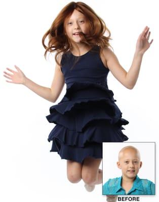 HairArt - Hair Replacement Solutions