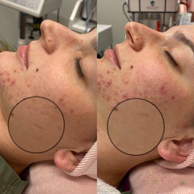 Skin Craft Facial Lounge