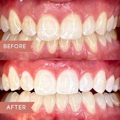 Client came in and left in a little over an hour with a 6 shade difference!!