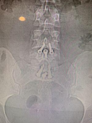 You can see the placement of The 6 screws