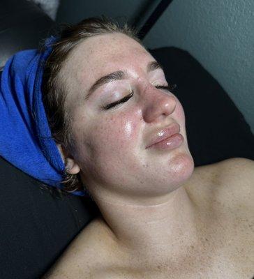 Hydroglow with Dermaplane facial