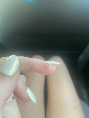 Huge bump and lifted