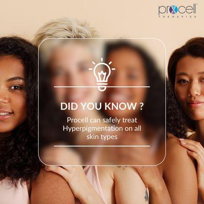 Procell microchanneling treats hyperpigmentation on all skin types.