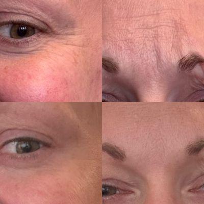 Paul Stallman, MD - Stallman Cosmetic Surgery