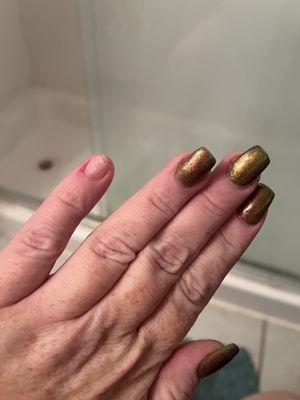 Pink nail fell off