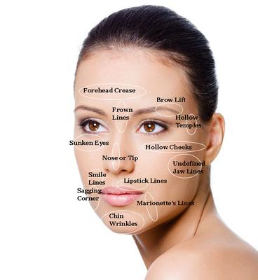 Dermal fillers / Botox, Xeomin & Dysport