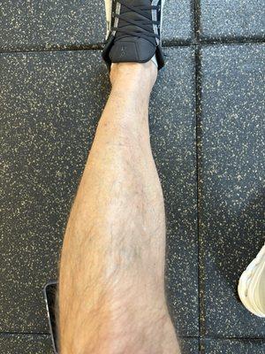 Elmore Medical Vein and Laser Treatment Center