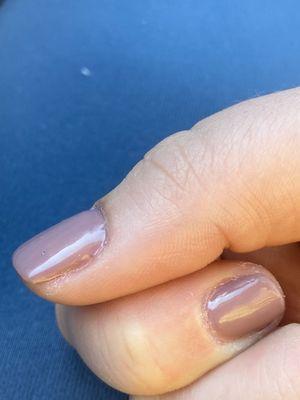 Tiny dark spec on thumb