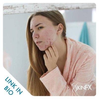 Botox Bellingham Alternative