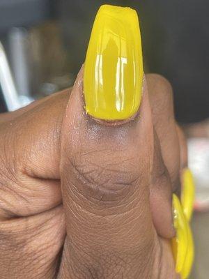 Left thumb... Bad shape ... and I'm bleeding