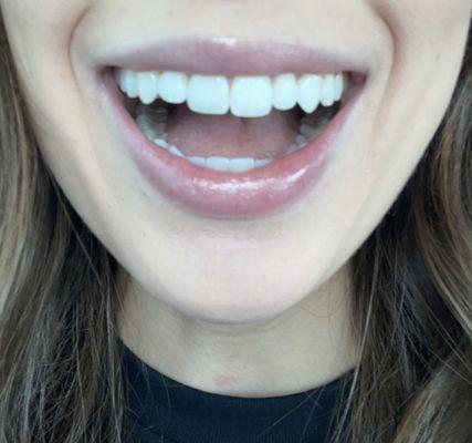 Ossman Harding Dental