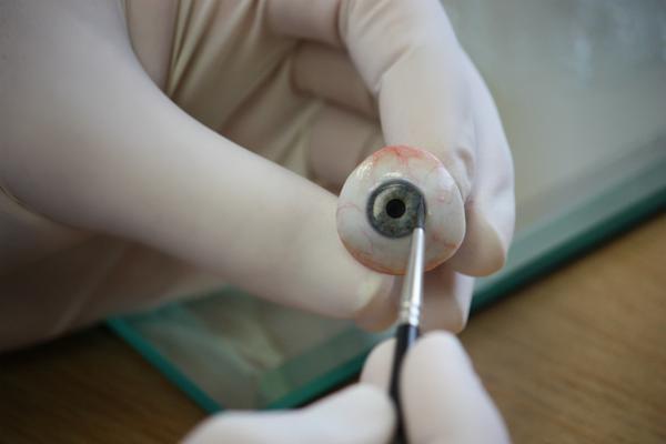 Midwest Eye Laboratories