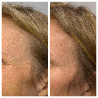 Your Laser Skin Care