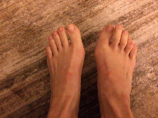 My $30 "pedicure."