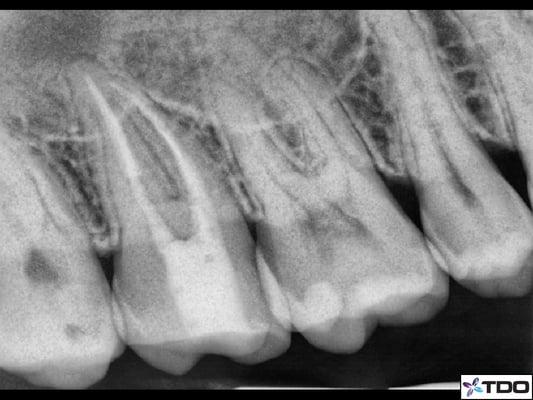 After Dr. Yamada's work Before Dr. Alibhai's work