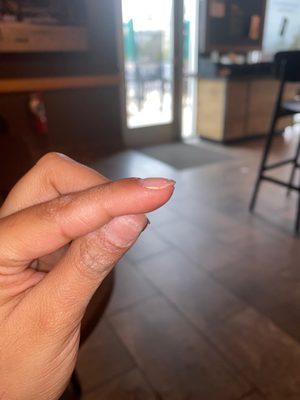 I don't see a curve in my nail bed