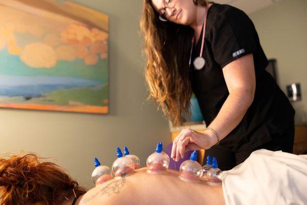 Cupping with Acupuncture