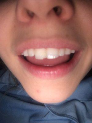 Pleasant Dental Care