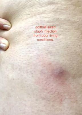 The Lodge on the Chattahoochee