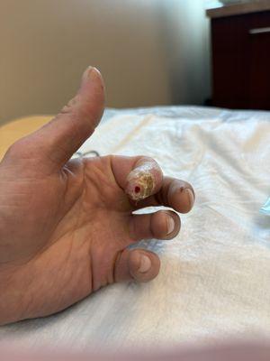 Colorado Springs Orthopaedic Group