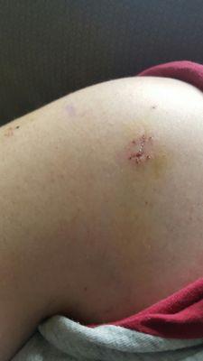 Crystal Clinic Physical Therapy Services