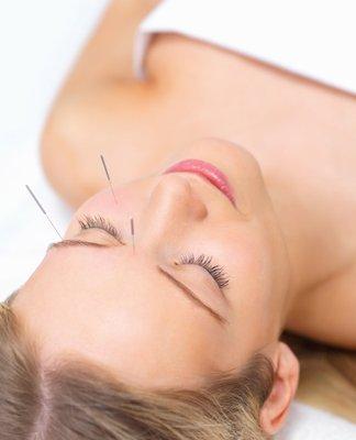 AcuRadiance's Non-Surgical Facial Rejuvenation is considered as Modern Acupuncture Technique. Based on Oriental Medicine Theory, Acupunctur