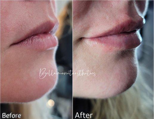 Bella Monet' Aesthetics