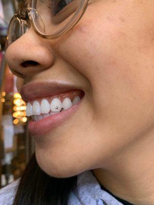 White gold star tooth charm, San Francisco