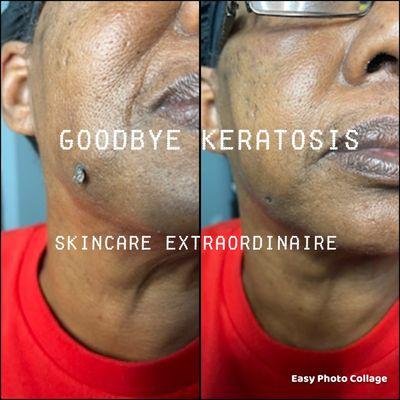 The Skincare Extraordinaire