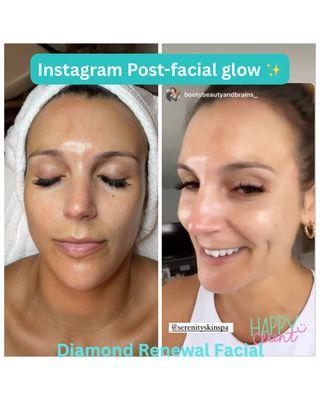My long-time client couldn't wait to share her results on IG! With consistent facials, her brown spots have faded and her skin keeps glowing