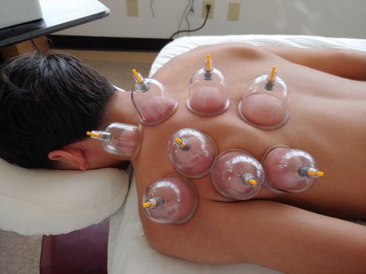 Tightness released and mobility improved.