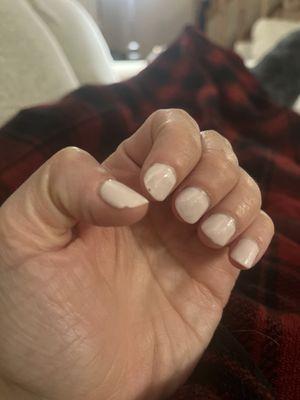 Chipped nails