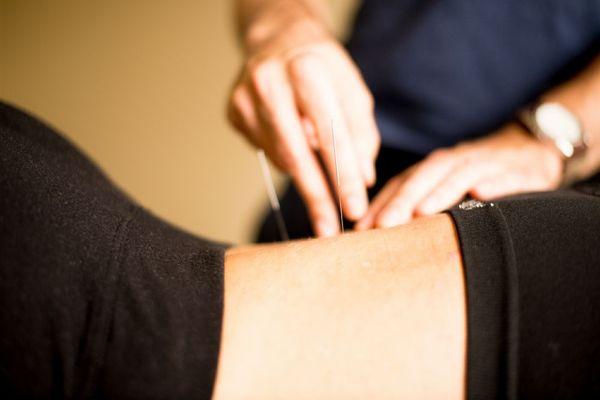 Messina Acupuncture PC