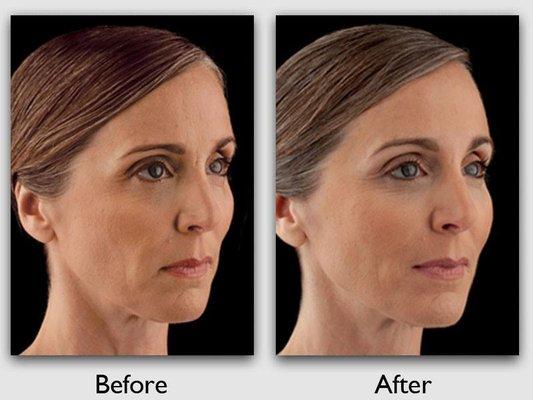 Advanced Centre For Plastic Surgery