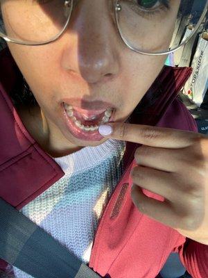 CT Braces - New Haven Orthodontics