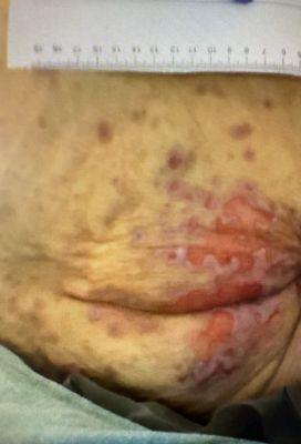 Autumn Hills Health Care Center