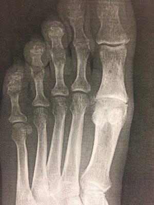 Stonewall Apartments