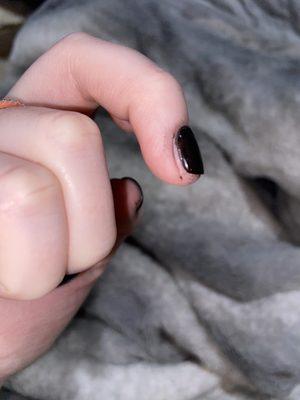 Another finger with the nail not being completely covered