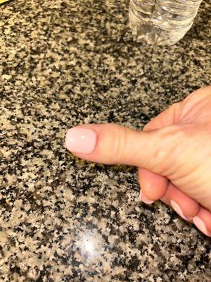 Right hand thumb - redness and pain at the cuticle.