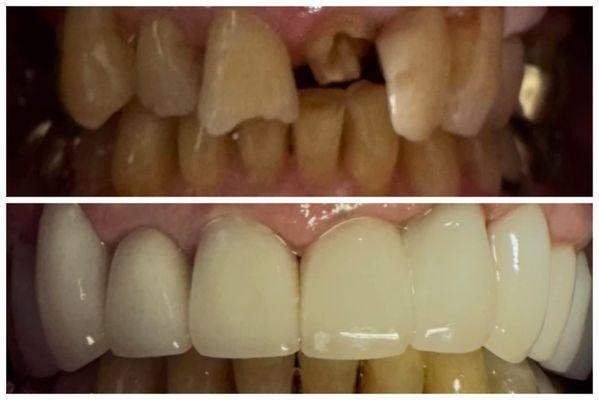 Pinnacle Hills Dental Group