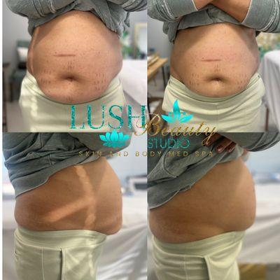 Lotus Wellness and Esthetics