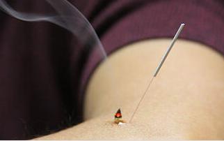 Bocangel Integrative Medicine & Acupuncture