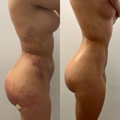 Revealing Body - San Diego