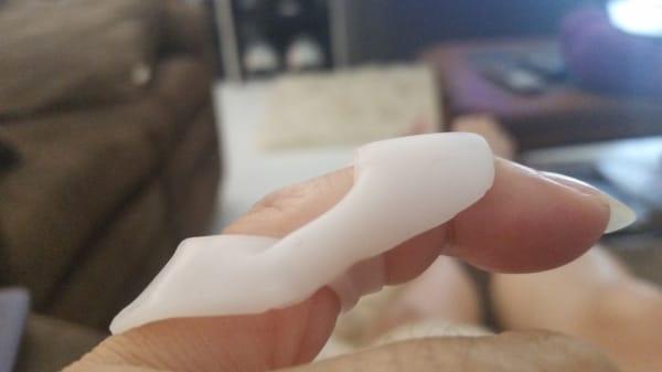 This is the splint that cost $187.00