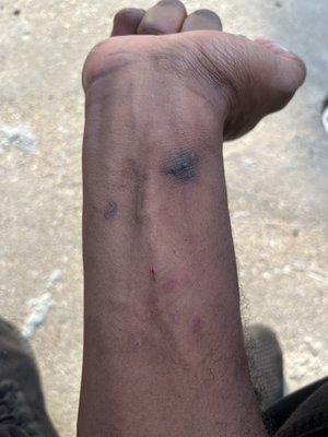 A visible injury from the employee in question.