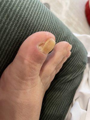 Watching it rot away