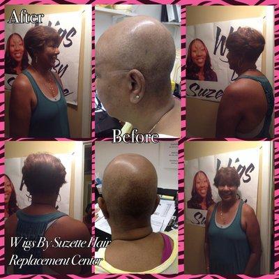 Wigs By Suzette Hair Replacement Center
