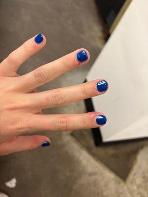 pointer finger infection