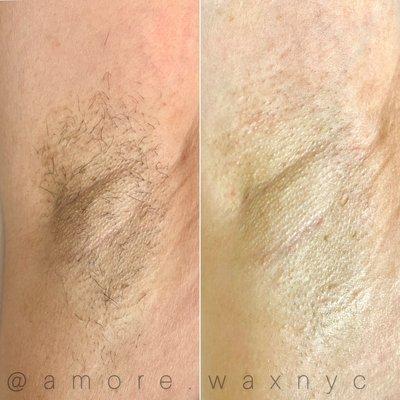 Why Wax ?
Removes Dead Skin Cells
Helps unblock clogged pores
Keep your skin hairless for 2-3 weeks
Brightens up the skin