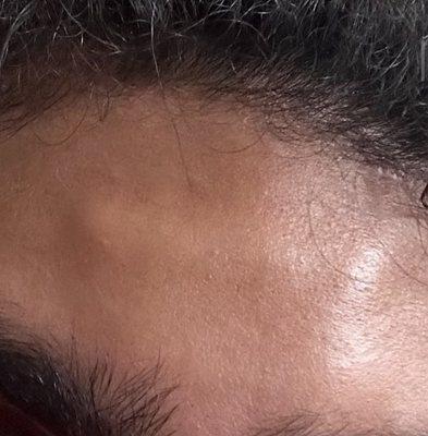 Entire Plate Sticking out